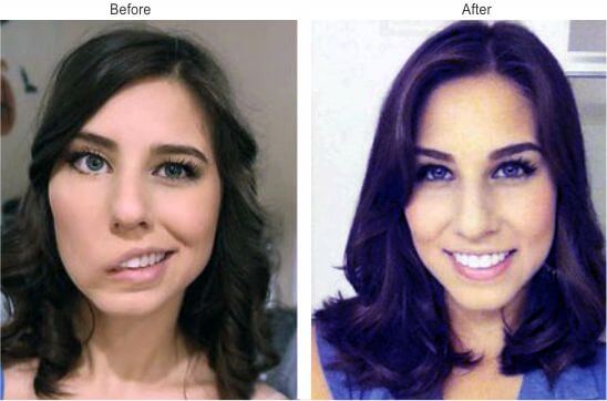 img-surgery